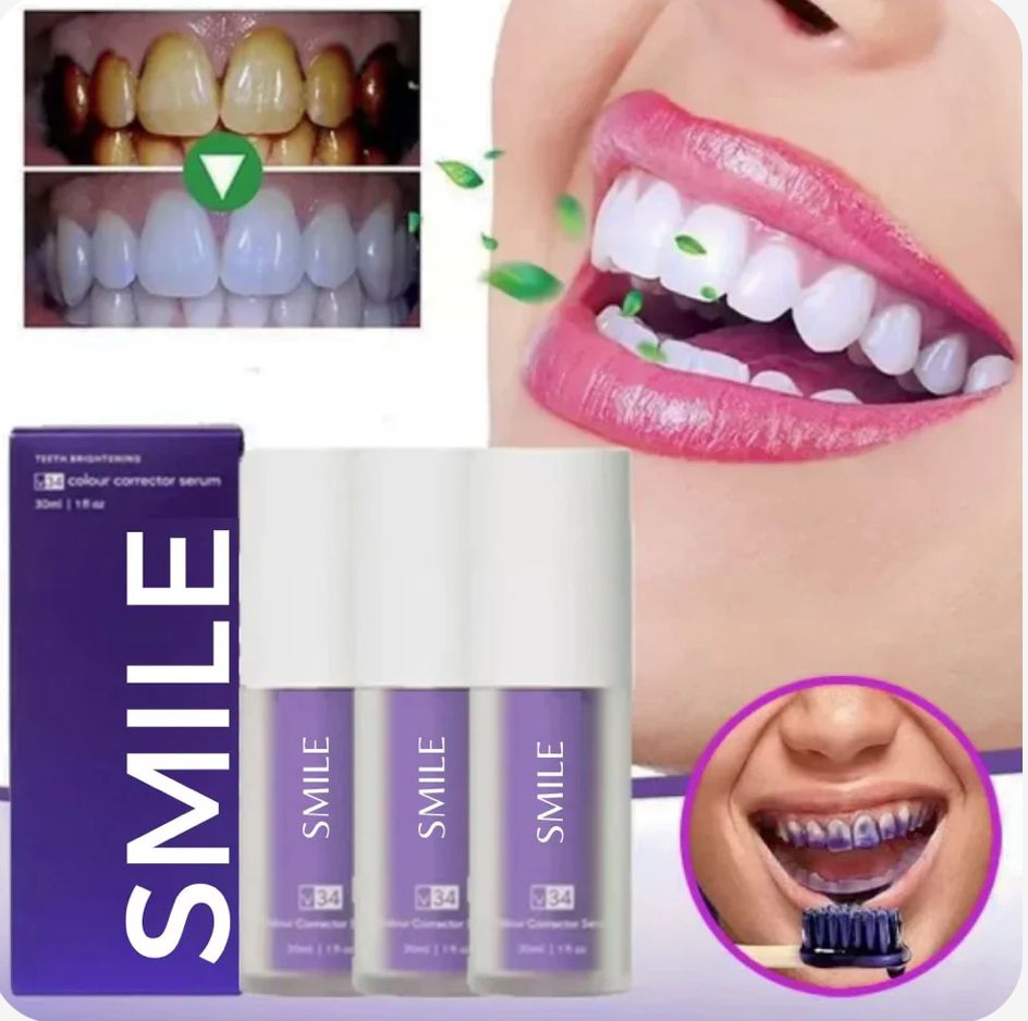 Blanqueador Dental SMILE V34 (Oferta 2X1)