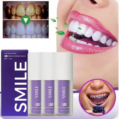 Blanqueador Dental SMILE V34 (Oferta 2X1)