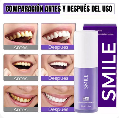 Blanqueador Dental SMILE V34 (Oferta 2X1)
